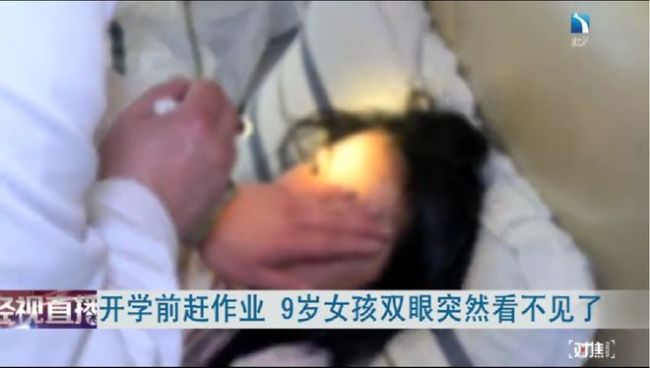 27岁女生挤颗痘痘,进了手术室!别忽略糖尿病的早期警报